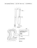 Endoscope with Integrated Sensors diagram and image