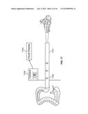 Endoscope with Integrated Sensors diagram and image