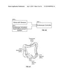 Endoscope with Integrated Sensors diagram and image