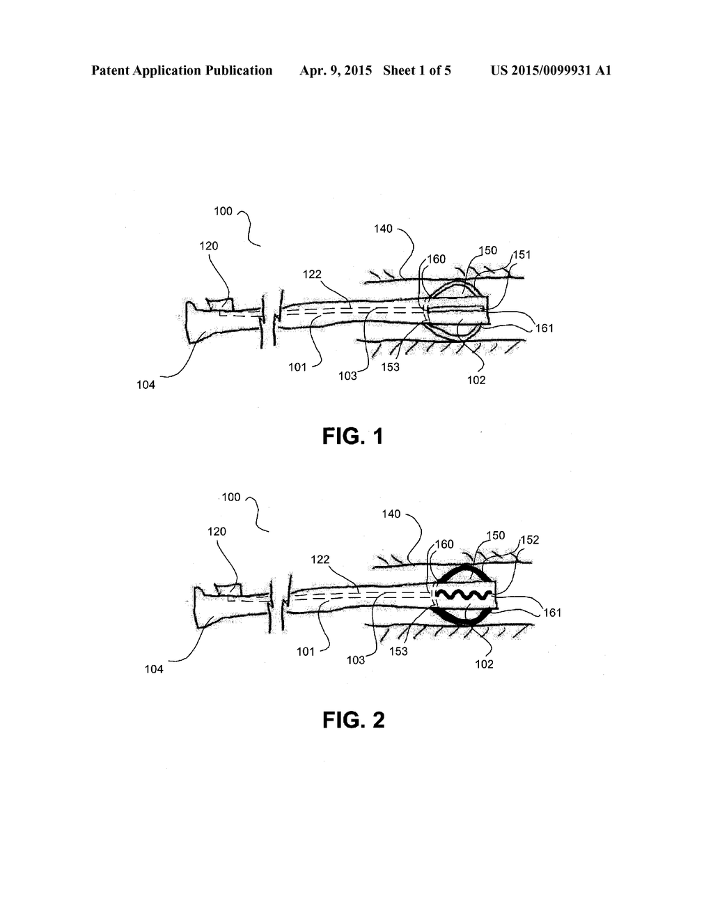 ENDOSCOPE ANCHORING DEVICE - diagram, schematic, and image 02