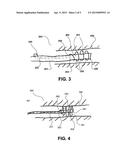 ENDOSCOPE ANCHORING DEVICE diagram and image