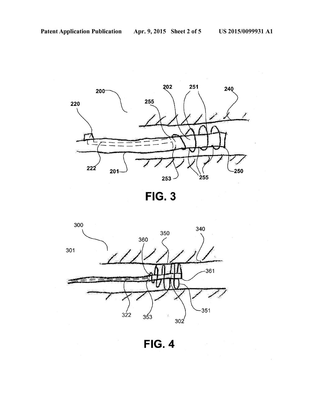 ENDOSCOPE ANCHORING DEVICE - diagram, schematic, and image 03