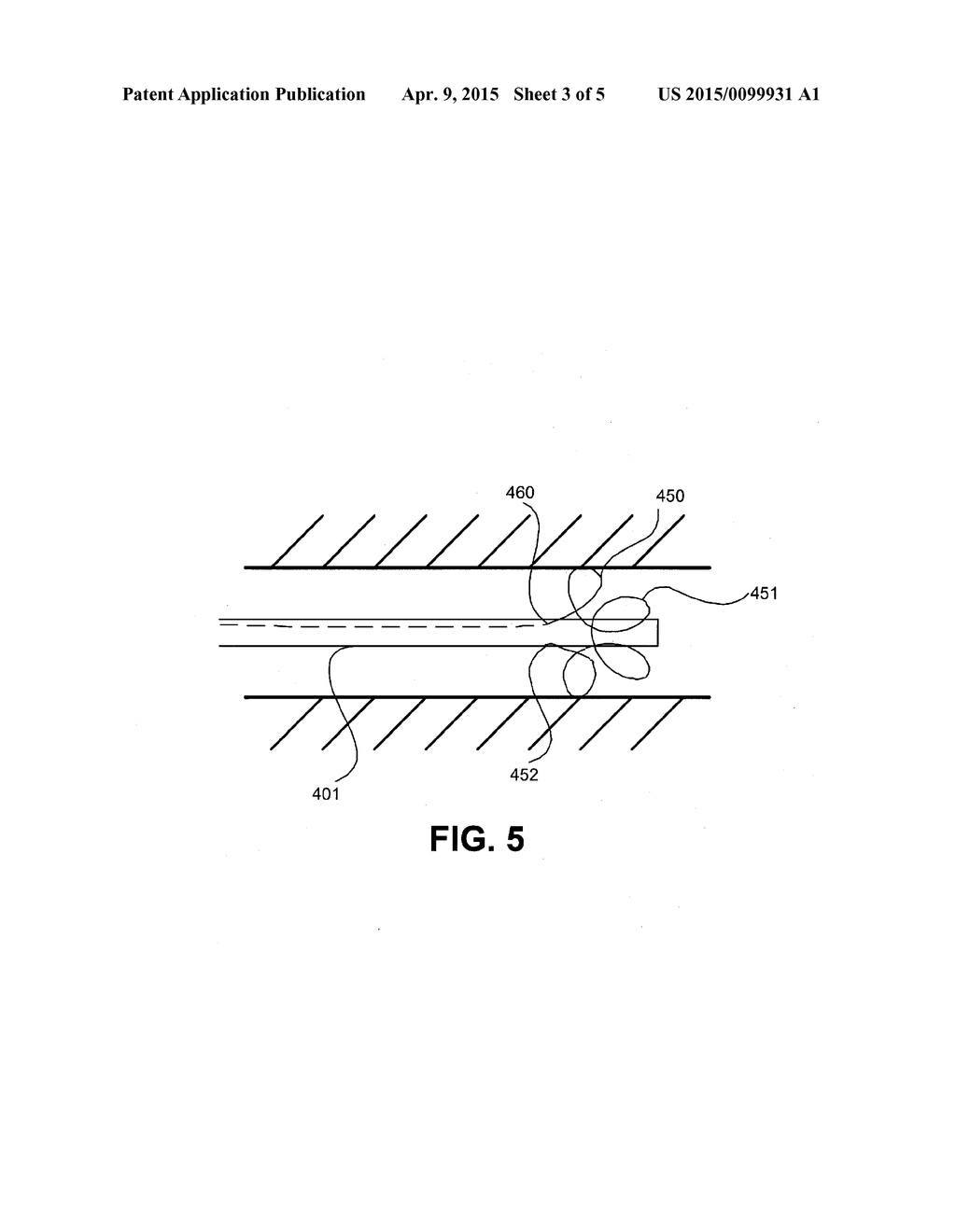 ENDOSCOPE ANCHORING DEVICE - diagram, schematic, and image 04