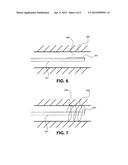 ENDOSCOPE ANCHORING DEVICE diagram and image