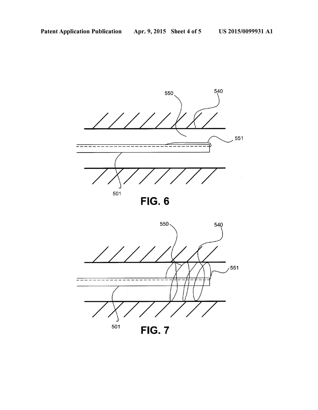 ENDOSCOPE ANCHORING DEVICE - diagram, schematic, and image 05