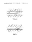 ENDOSCOPE ANCHORING DEVICE diagram and image