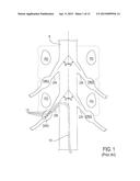 SHEATH SUPPORT DEVICES, SYSTEMS AND METHODS diagram and image