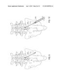 SHEATH SUPPORT DEVICES, SYSTEMS AND METHODS diagram and image