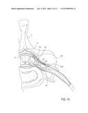 SHEATH SUPPORT DEVICES, SYSTEMS AND METHODS diagram and image