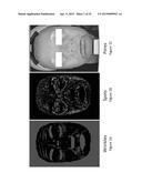 SKIN YOUTHFULNESS INDEX, METHODS AND APPLICATIONS THEREOF diagram and image