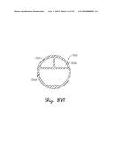 SYSTEMS, METHODS, AND DEVICES USING STRETCHABLE OR FLEXIBLE ELECTRONICS     FOR MEDICAL APPLICATIONS diagram and image