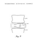 SYSTEMS, METHODS, AND DEVICES USING STRETCHABLE OR FLEXIBLE ELECTRONICS     FOR MEDICAL APPLICATIONS diagram and image