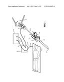 SCANNING CANNULA diagram and image