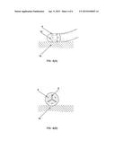 Ablation Catheter Electrode having Multiple Thermal Sensors and Method of     Use diagram and image