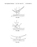 Ablation Catheter Electrode having Multiple Thermal Sensors and Method of     Use diagram and image