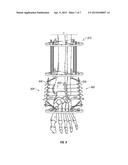 FOOT, ANKLE AND LOWER EXTREMITY COMPRESSION AND FIXATION SYSTEM AND     RELATED USES diagram and image