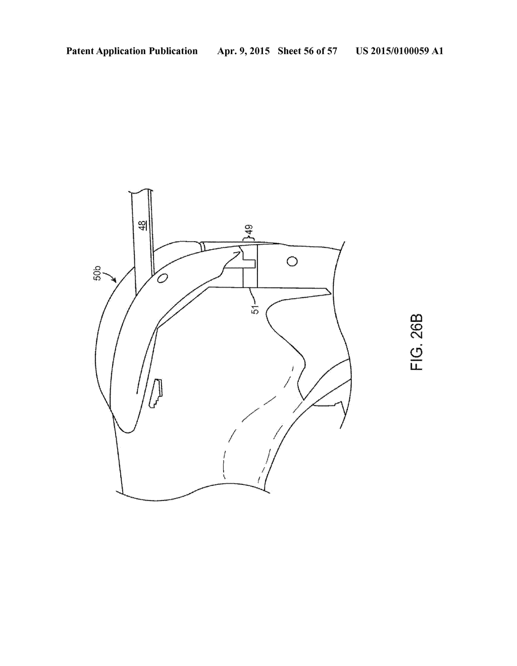 KNEE BALANCING FOR REVISION PROCEDURES - diagram, schematic, and image 57