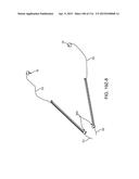 METHOD FOR PROVIDING SURGICAL ACCESS diagram and image