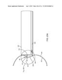 METHOD FOR PROVIDING SURGICAL ACCESS diagram and image