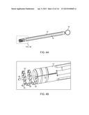 METHOD FOR PROVIDING SURGICAL ACCESS diagram and image