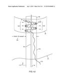 METHOD FOR PROVIDING SURGICAL ACCESS diagram and image