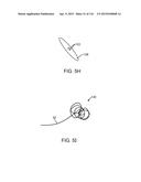 METHOD FOR PROVIDING SURGICAL ACCESS diagram and image