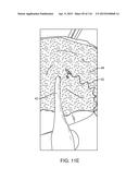 METHOD FOR PROVIDING SURGICAL ACCESS diagram and image