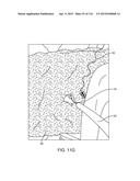 METHOD FOR PROVIDING SURGICAL ACCESS diagram and image