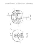 METHOD FOR PROVIDING SURGICAL ACCESS diagram and image