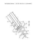 METHOD FOR PROVIDING SURGICAL ACCESS diagram and image