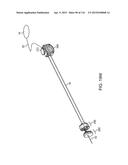 METHOD FOR PROVIDING SURGICAL ACCESS diagram and image