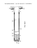 METHOD FOR PROVIDING SURGICAL ACCESS diagram and image