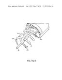 METHOD FOR PROVIDING SURGICAL ACCESS diagram and image