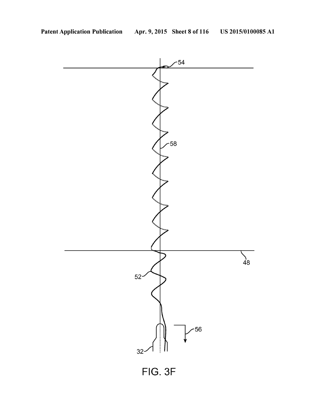 SYSTEM FOR PROVIDING SURGICAL ACCESS - diagram, schematic, and image 09