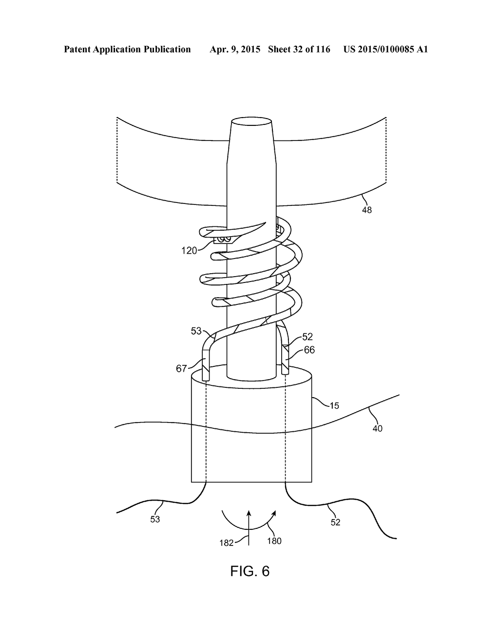 SYSTEM FOR PROVIDING SURGICAL ACCESS - diagram, schematic, and image 33