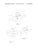 SYSTEM AND METHOD FOR SECURING AN IMPLANT TO TISSUE diagram and image