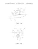 SYSTEM AND METHOD FOR SECURING AN IMPLANT TO TISSUE diagram and image