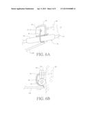 SYSTEM AND METHOD FOR SECURING AN IMPLANT TO TISSUE diagram and image