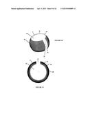 Polyaxial Plate Rod System and Surgical Procedure diagram and image