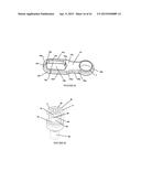 Polyaxial Plate Rod System and Surgical Procedure diagram and image