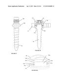 Polyaxial Plate Rod System and Surgical Procedure diagram and image