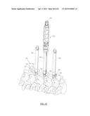 Systems and Methods for Performing Spine Surgery diagram and image