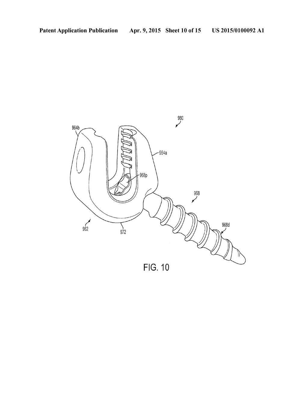 SYSTEM AND METHOD FOR CERVICAL MIDLINE FIXATION - diagram, schematic, and image 11