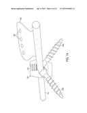 SYSTEM AND METHOD FOR CERVICAL MIDLINE FIXATION diagram and image