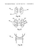 BONE PLATES, SCREWS AND INSTRUMENTS diagram and image