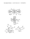 BONE PLATES, SCREWS AND INSTRUMENTS diagram and image