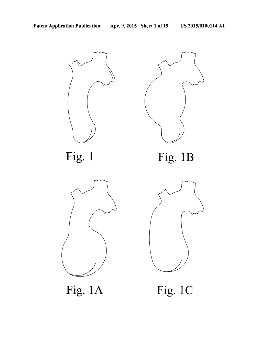 DEVICE FOR ENDOVASCULAR AORTIC REPAIR AND METHOD OF USING THE SAME - diagram, schematic, and image 02