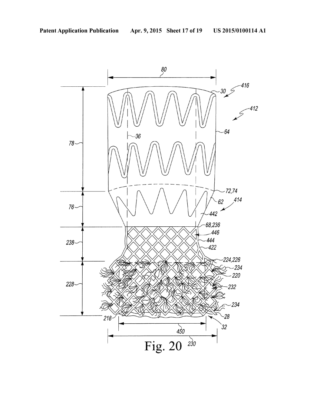 DEVICE FOR ENDOVASCULAR AORTIC REPAIR AND METHOD OF USING THE SAME - diagram, schematic, and image 18