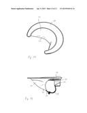 IMPLANT AND METHOD FOR IMPROVING COAPTATION OF AN ATRIOVENTRICULAR VALVE diagram and image