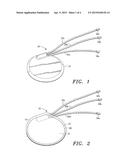 Extracellular Matrix Encasement Structures and Methods diagram and image